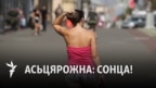 Чаму рак скуры — адна з найбольш распаўсюджаных анкалягічных хваробаў у Беларусі